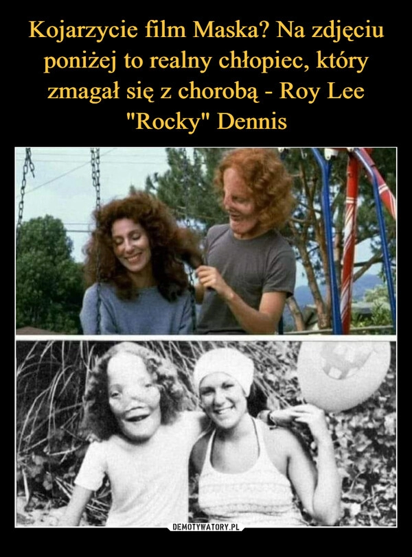 
    Kojarzycie film Maska? Na zdjęciu poniżej to realny chłopiec, który zmagał się z chorobą - Roy Lee "Rocky" Dennis