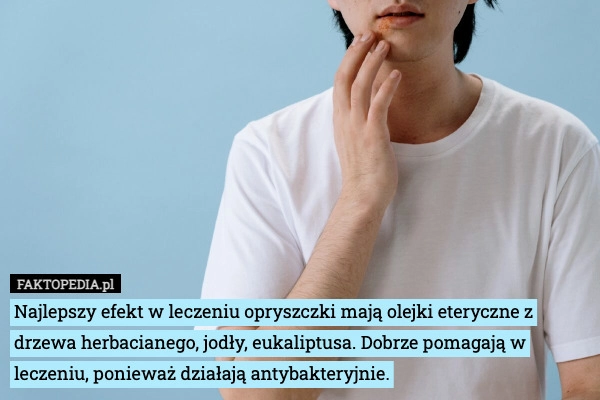 
    Najlepszy efekt w leczeniu opryszczki mają olejki eteryczne z drzewa herbacianego,