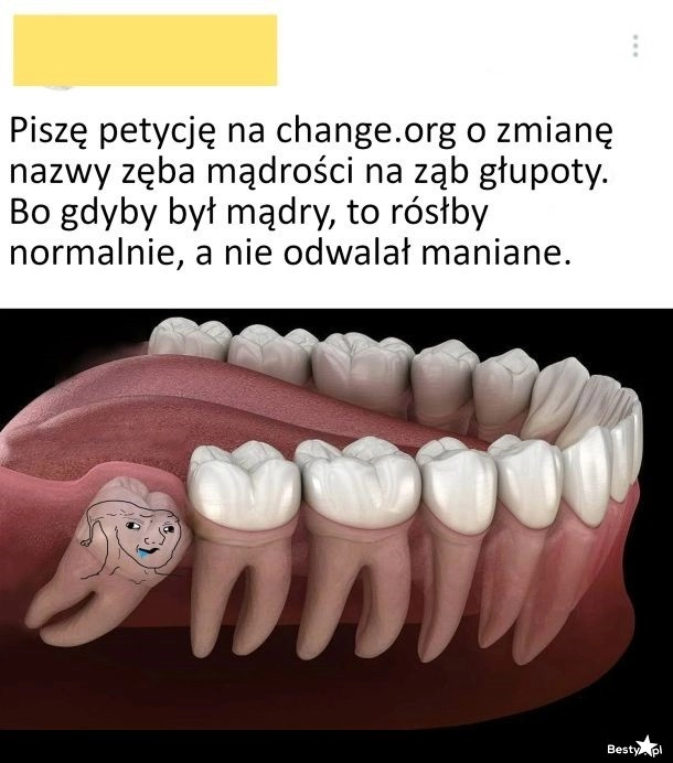 
    Zęby mądrości 