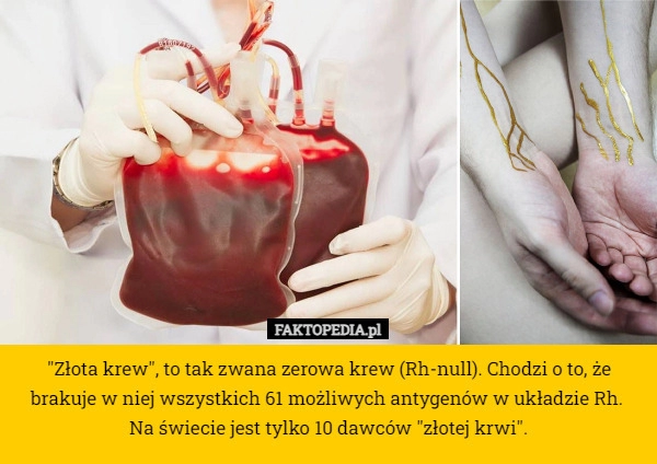 
    "Złota krew", to tak zwana zerowa krew (Rh-null). Chodzi o to,