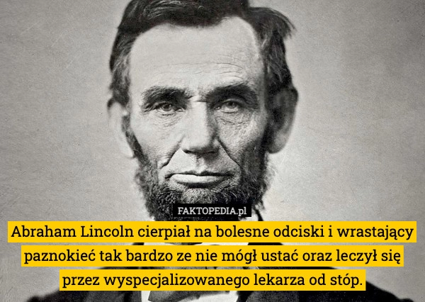 
    Abraham Lincoln cierpiał na bolesne odciski i wrastający paznokieć tak bardzo