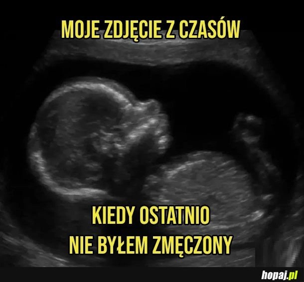 
    Kiedyś to było