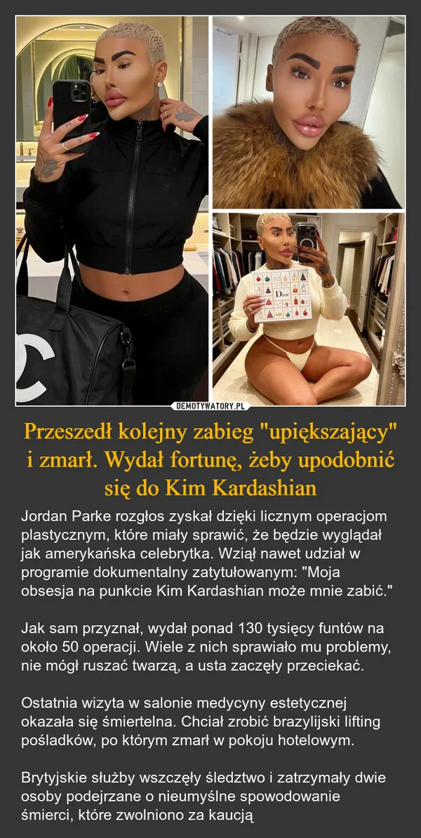 
    Przeszedł kolejny zabieg 