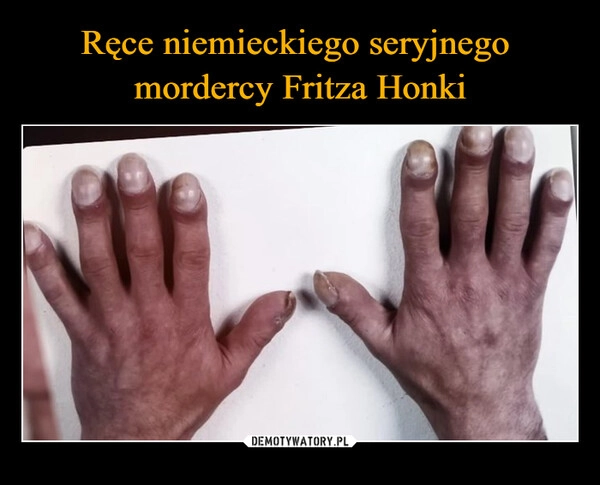 
    Ręce niemieckiego seryjnego 
mordercy Fritza Honki