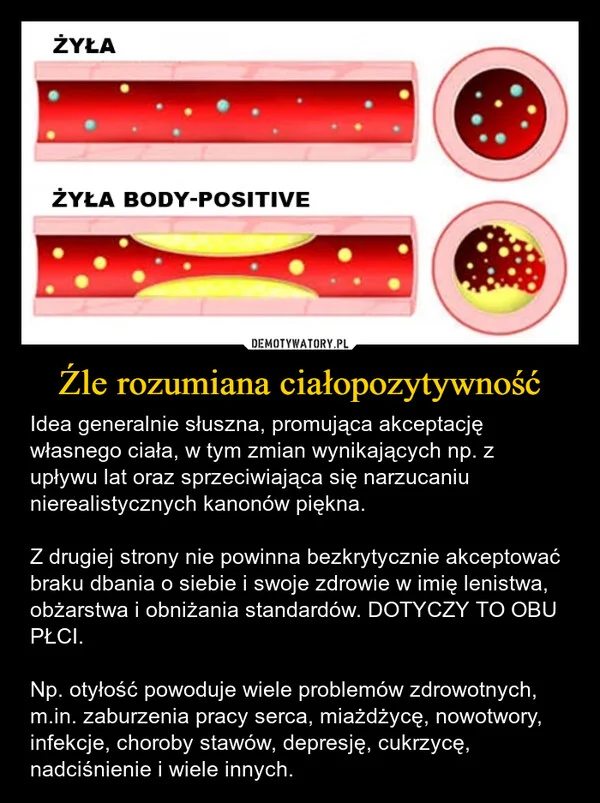
    Źle rozumiana ciałopozytywność