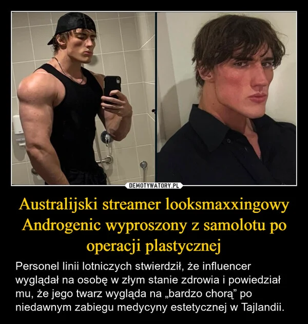 Australijski streamer looksmaxxingowy Androgenic wyproszony z samolotu po operacji plastycznej