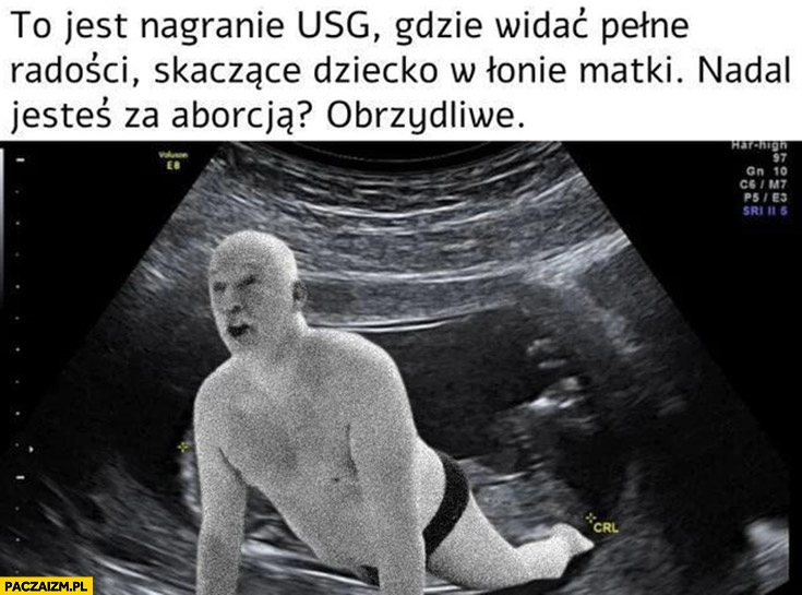 
    Korwin to jest nagranie USG gdzie widać dziecko skaczące w łonie matki nadal jesteś za aborcją? Obrzydliwe