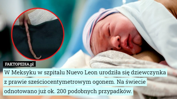 
    
			W Meksyku w szpitalu Nuevo Leon urodziła się dziewczynka z prawie sześciocentymetrowym...					