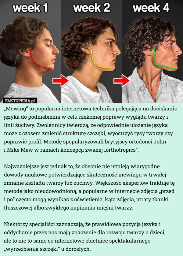 
    „Mewing” to popularna internetowa technika polegająca na dociskaniu języka...