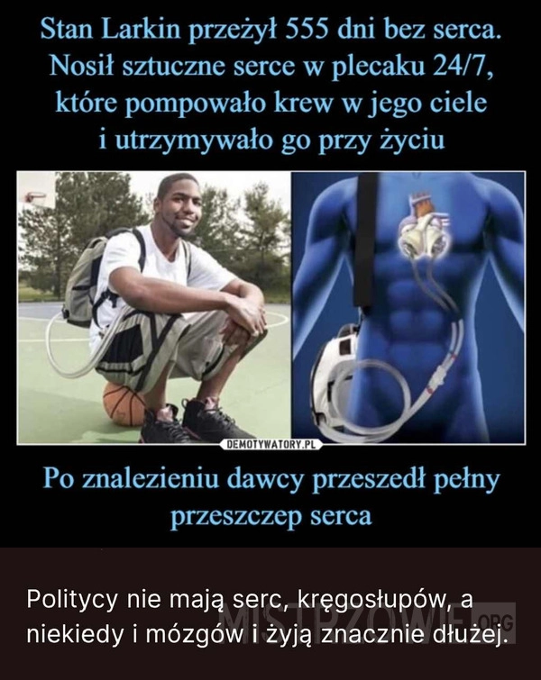 
    Przeżył 555 dni bez serca