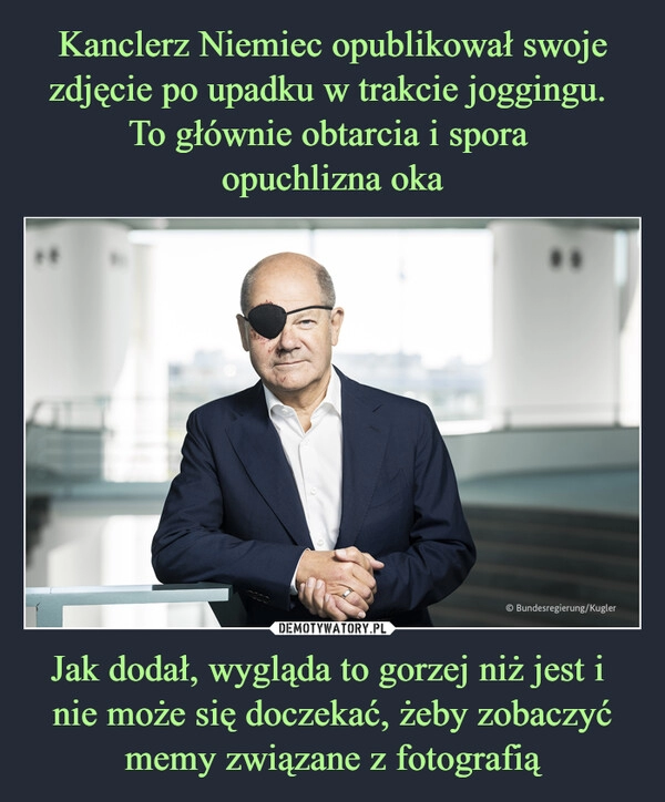 
    Kanclerz Niemiec opublikował swoje zdjęcie po upadku w trakcie joggingu. 
To głównie obtarcia i spora 
opuchlizna oka Jak dodał, wygląda to gorzej niż jest i 
nie może się doczekać, żeby zobaczyć memy związane z fotografią