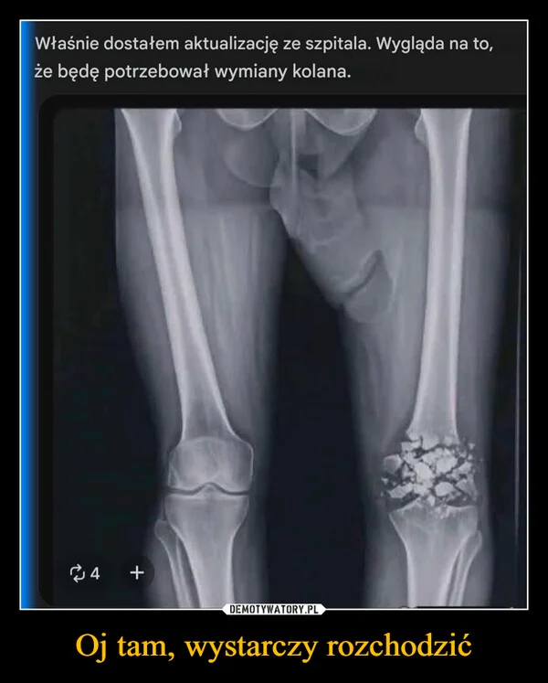 
    Oj tam, wystarczy rozchodzić