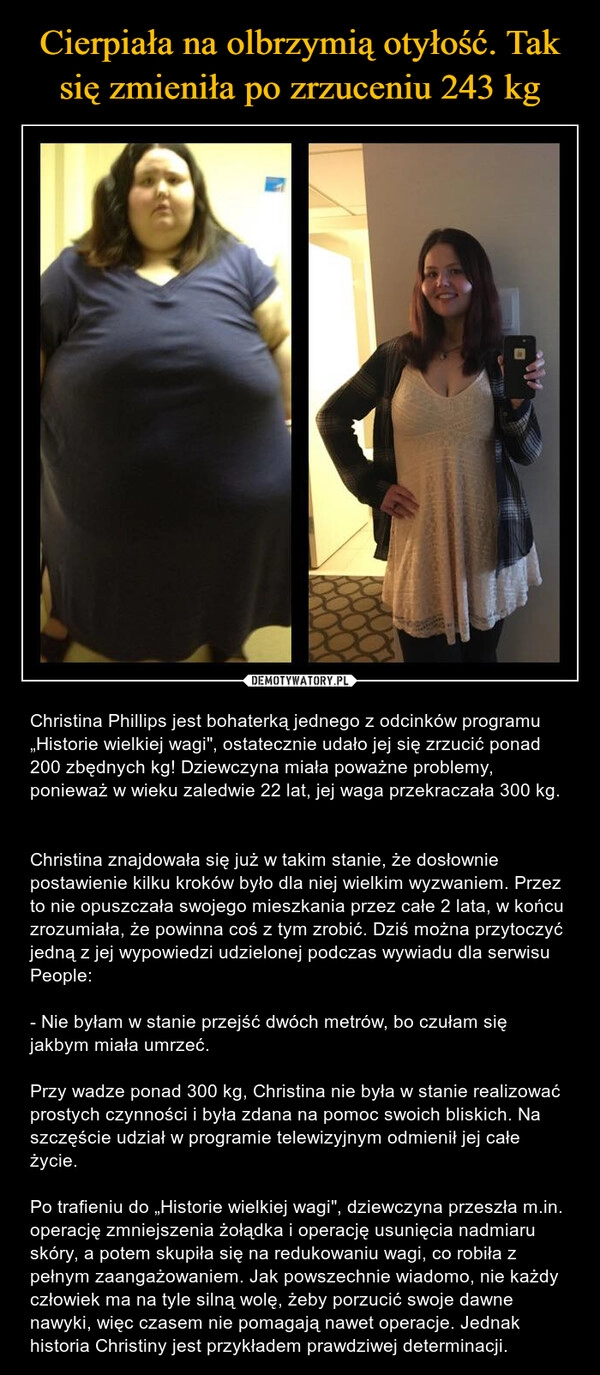 
    Cierpiała na olbrzymią otyłość. Tak się zmieniła po zrzuceniu 243 kg