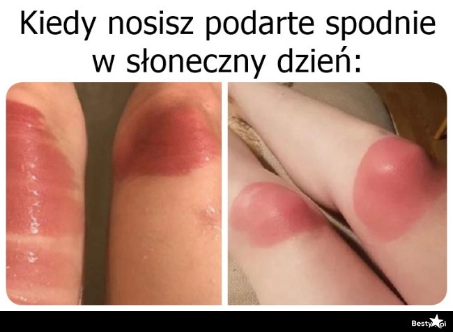 
    Troszkę przypaliło 