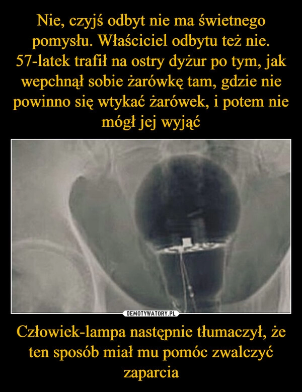 
    Nie, czyjś odbyt nie ma świetnego pomysłu. Właściciel odbytu też nie. 57-latek trafił na ostry dyżur po tym, jak wepchnął sobie żarówkę tam, gdzie nie powinno się wtykać żarówek, i potem nie mógł jej wyjąć Człowiek-lampa następnie tłumaczył, że ten sposób miał mu pomóc zwalczyć zaparcia