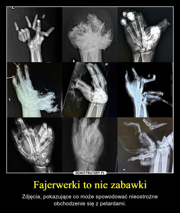 
    Fajerwerki to nie zabawki