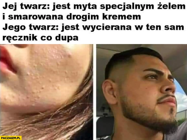 
    Jej twarz pryszcze: myta specjalnym żelem, smarowana drogim kremem, jego twarz idealna: wycierana w ten sam ręcznik co dupa