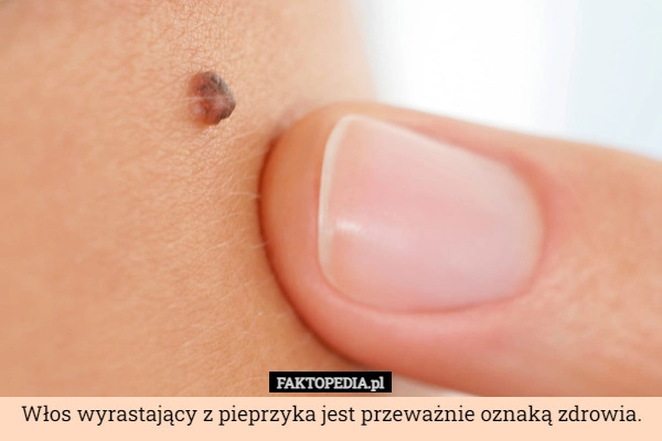 
    Włos wyrastający z pieprzyka jest przeważnie oznaką zdrowia.