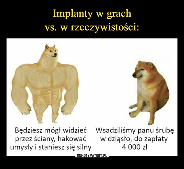 
    Implanty w grach
vs. w rzeczywistości: