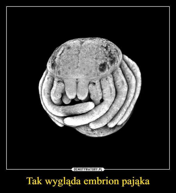 
    Tak wygląda embrion pająka