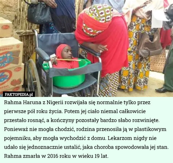 
    Rahma Haruna z Nigerii rozwijała się normalnie tylko przez pierwsze pół...