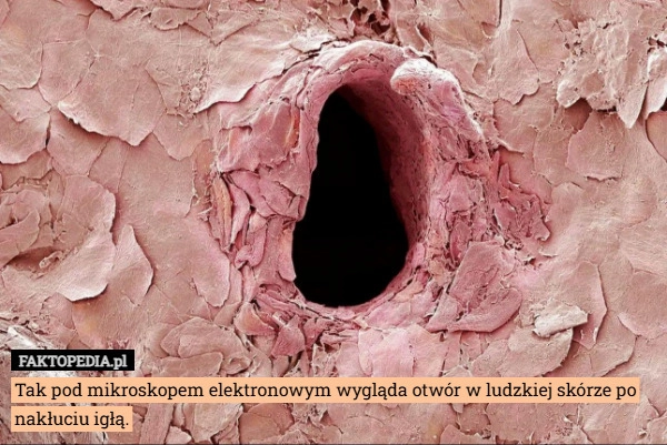 
    Tak pod mikroskopem elektronowym wygląda otwór w ludzkiej skórze po nakłuciu