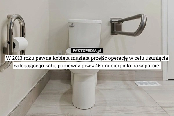 
    W 2013 roku pewna kobieta musiała przejść operację w celu usunięcia zalegającego