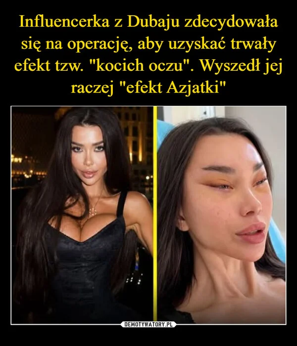 Influencerka z Dubaju zdecydowała się na operację, aby uzyskać trwały efekt tzw. 