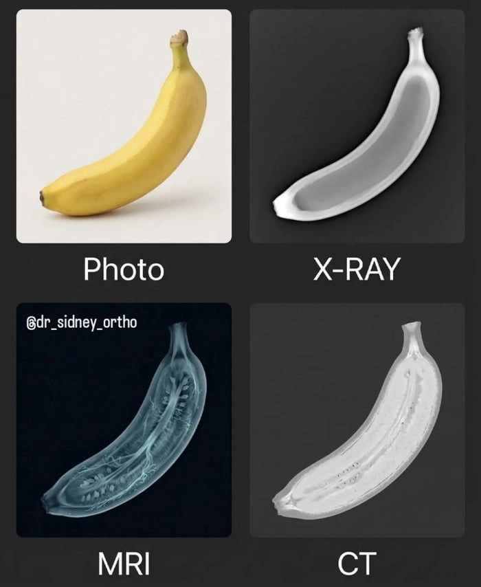 
    Banana for scan