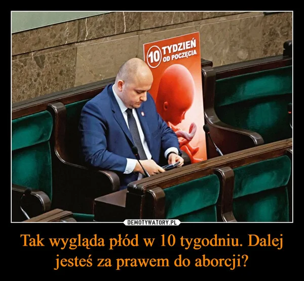 
    Tak wygląda płód w 10 tygodniu. Dalej jesteś za prawem do aborcji?
