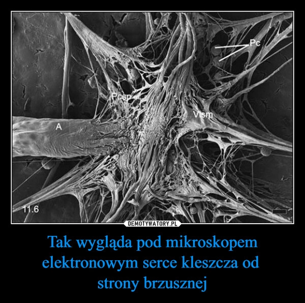 
    Tak wygląda pod mikroskopem elektronowym serce kleszcza od 
strony brzusznej