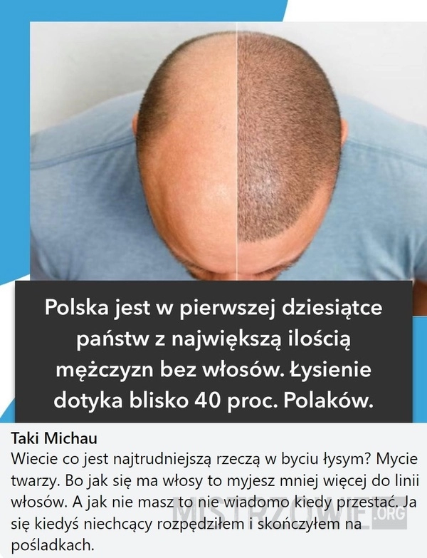 
    Włosy