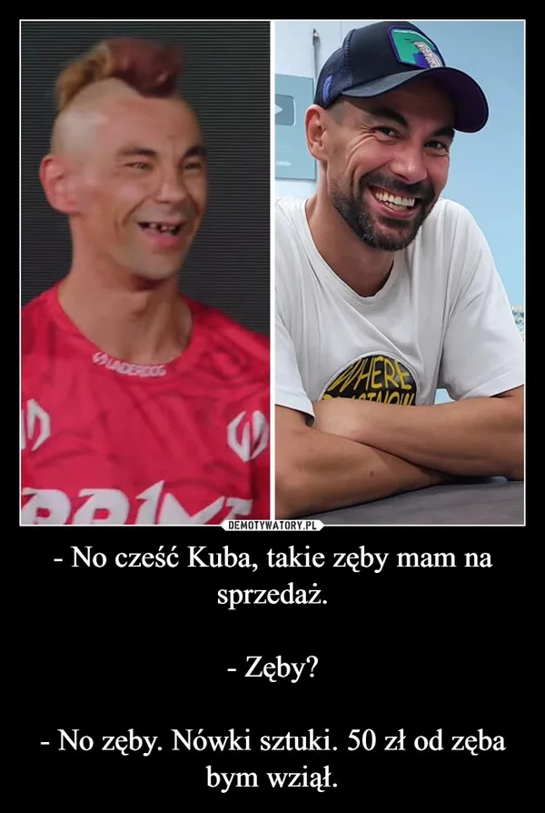 
    - No cześć Kuba, takie zęby mam na sprzedaż. - Zęby? - No zęby. Nówki sztuki. 50 zł od zęba bym wziął.