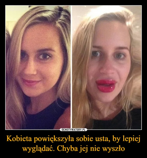 
    Kobieta powiększyła sobie usta, by lepiej wyglądać. Chyba jej nie wyszło