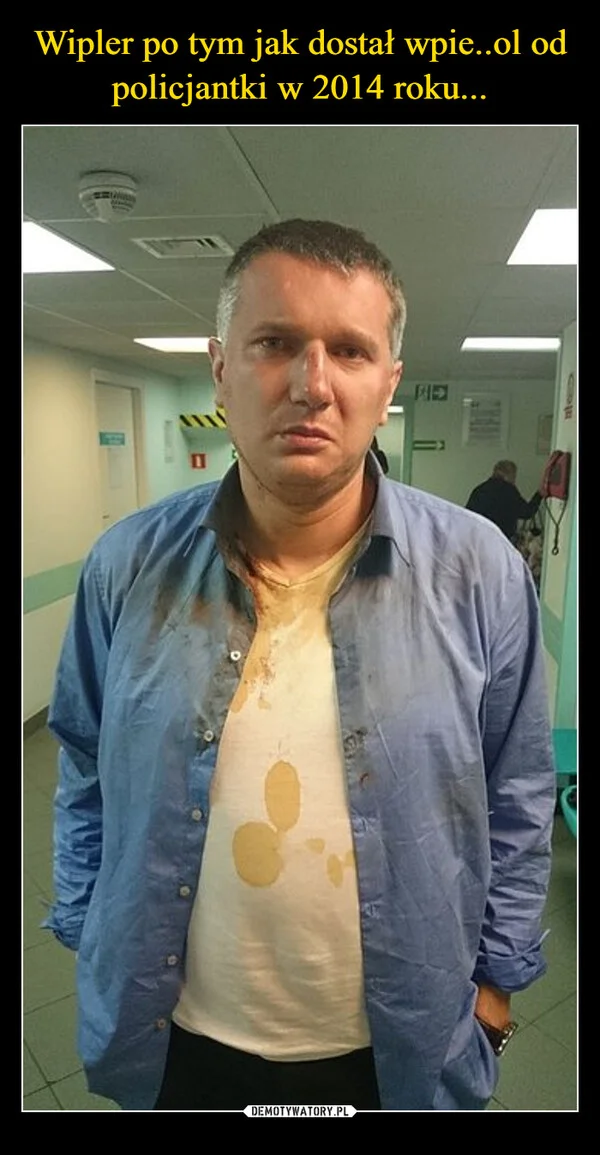 
    Wipler po tym jak dostał wpie..ol od policjantki w 2014 roku...