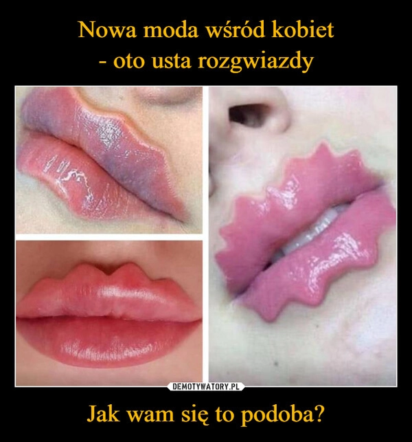 
    Nowa moda wśród kobiet
- oto usta rozgwiazdy Jak wam się to podoba?