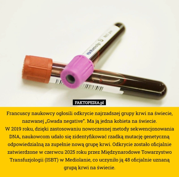 
    Francuscy naukowcy ogłosili odkrycie najrzadszej grupy krwi na świecie,