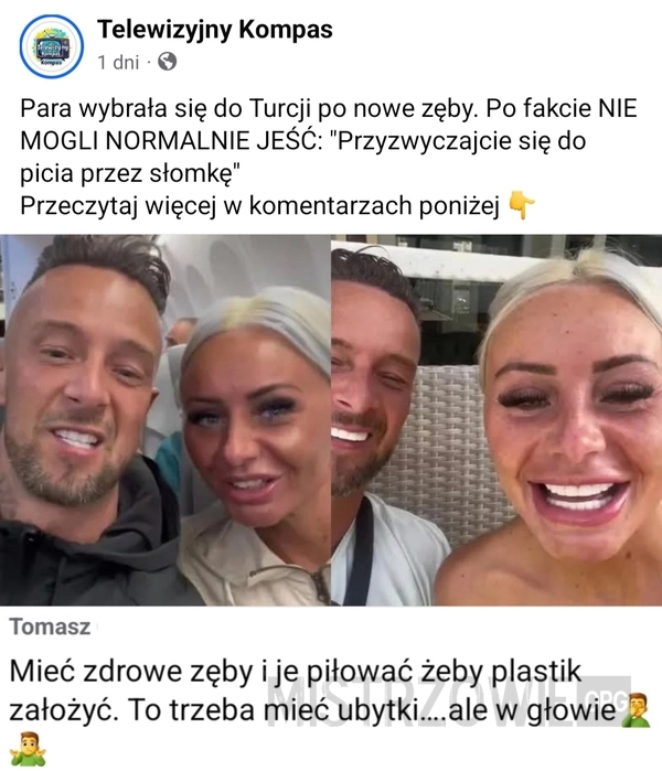 
    Zęby
