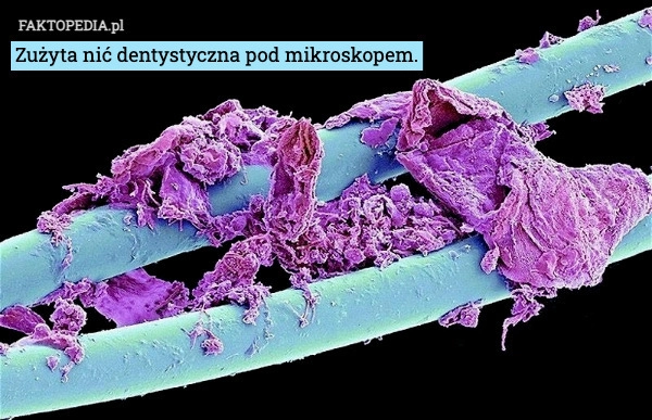 
    Zużyta nić dentystyczna pod mikroskopem.