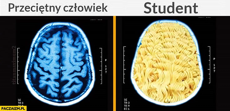 
    Przeciętny człowiek vs student makaron rezonans skan mózgu