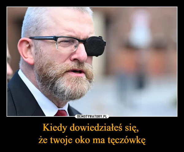 
    Kiedy dowiedziałeś się, że twoje oko ma tęczówkę