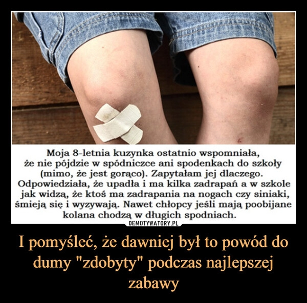 
    I pomyśleć, że dawniej był to powód do dumy "zdobyty" podczas najlepszej zabawy