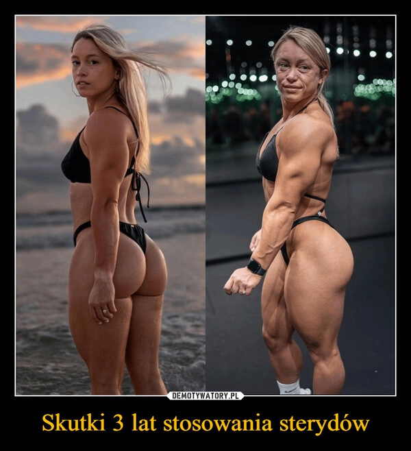 
    Skutki 3 lat stosowania sterydów