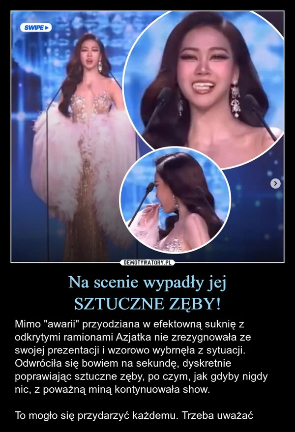 
    Na scenie wypadły jej SZTUCZNE ZĘBY!
