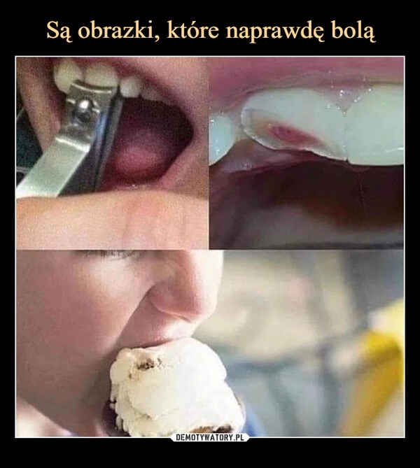 
    Są obrazki, które naprawdę bolą