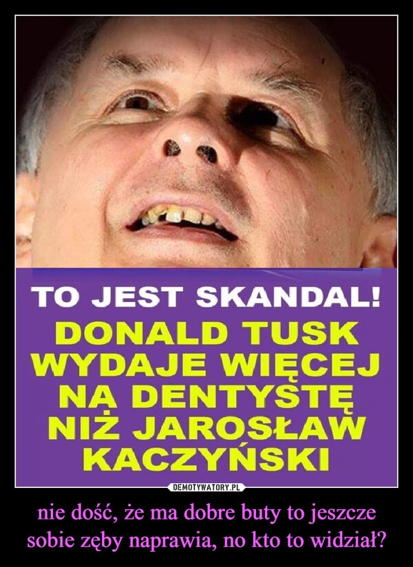 
    nie dość, że ma dobre buty to jeszcze sobie zęby naprawia, no kto to widział?