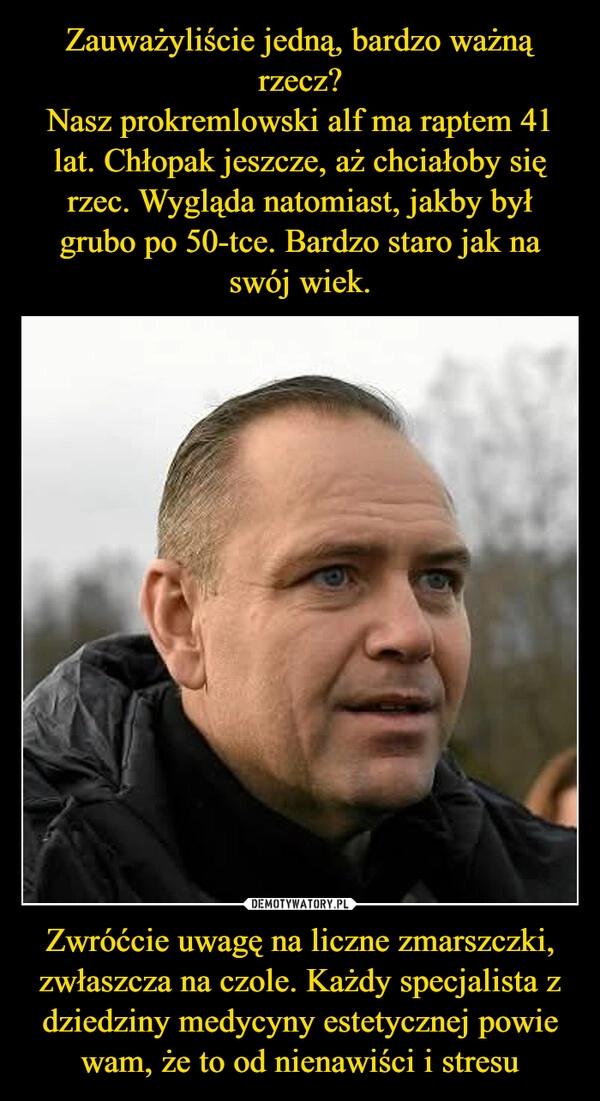 
    Zauważyliście jedną, bardzo ważną rzecz?
Nasz prokremlowski alf ma raptem 41 lat. Chłopak jeszcze, aż chciałoby się rzec. Wygląda natomiast, jakby był grubo po 50-tce. Bardzo staro jak na swój wiek. Zwróćcie uwagę na liczne zmarszczki, zwłaszcza na czole. Każdy specjalista z dziedziny medycyny estetycznej powie wam, że to od nienawiści i stresu