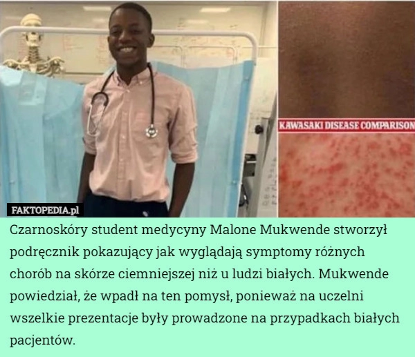 
    Czarnoskóry student medycyny Malone Mukwende stworzył podręcznik pokazujący