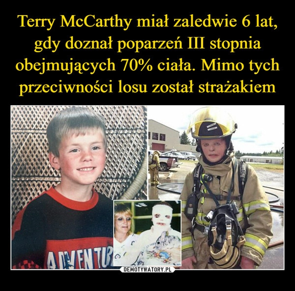 
    Terry McCarthy miał zaledwie 6 lat, gdy doznał poparzeń III stopnia obejmujących 70% ciała. Mimo tych przeciwności losu został strażakiem