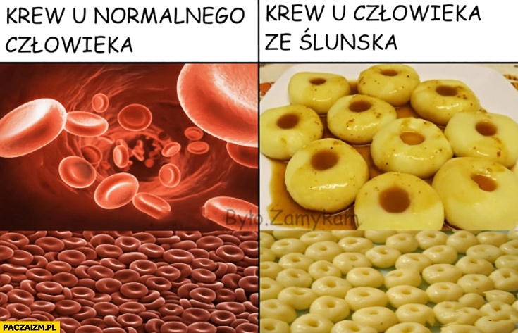 
    Krew u normalnego człowieka krew u człowieka ze Śląska kluski Śląskie